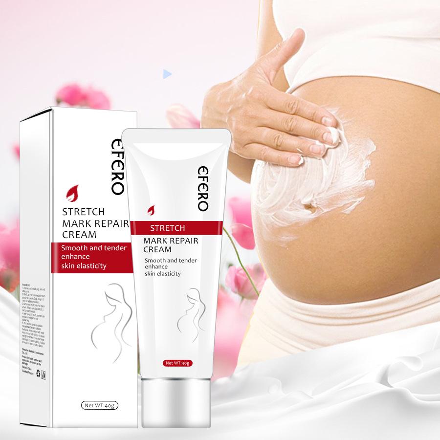 Stretch Mark Removal Cream